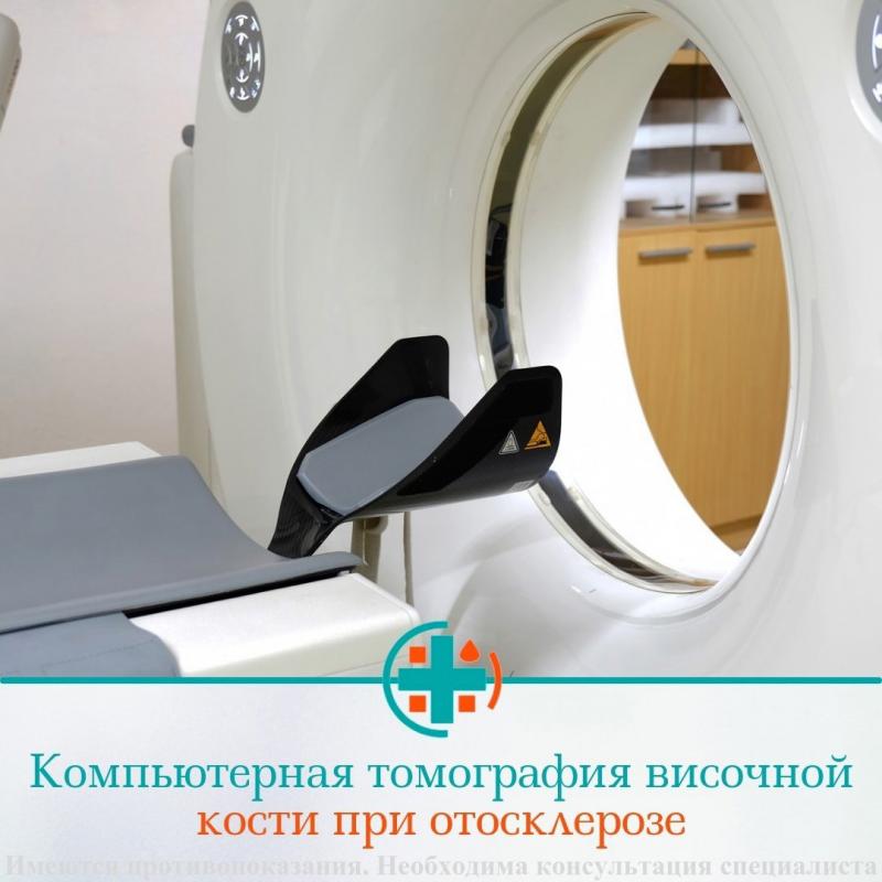 Компьютерная томография (КТ) височной кости при отосклерозе