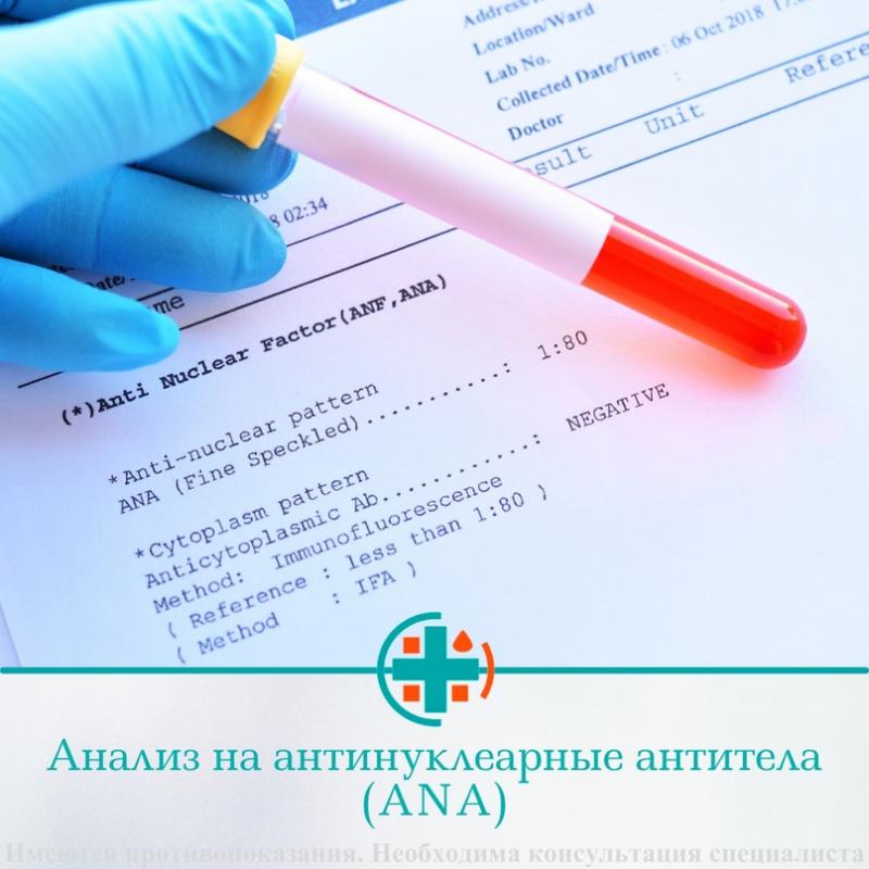 Анализ на антинуклеарные антитела (ANA)